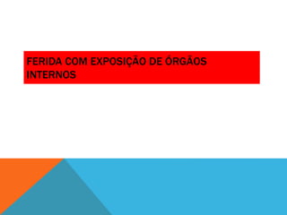 FERIDA COM EXPOSIÇÃO DE ÓRGÃOS
INTERNOS
 