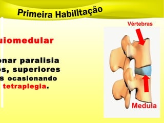 uiomedular
onar paralisia
os, superiores
s ocasionando
tetraplegia.
Vértebras
Medula
 