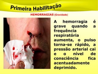 HEMORRAGIAS (Gravidade)
A hemorragia é
grave quando a
frequência
respiratória
aumenta, o pulso
torna-se rápido, a
pressão arterial cai
e o nível de
consciência fica
acentuadamente
deprimido.
 