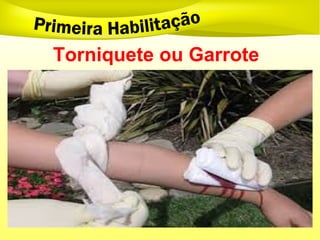 Torniquete ou Garrote
 