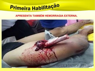 APRESENTA TAMBÉM HEMORRAGIA EXTERNA.
 