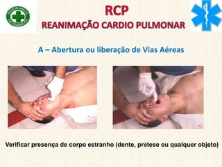 A – Abertura ou liberação de Vias Aéreas
Verificar presença de corpo estranho (dente, prótese ou qualquer objeto)
 