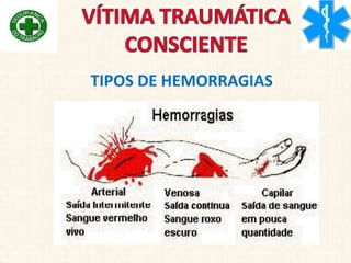 TIPOS DE HEMORRAGIAS
 