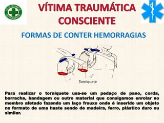 FORMAS DE CONTER HEMORRAGIAS
Torniquete
Para realizar o torniquete usa-se um pedaço de pano, corda,
borracha, bandagem ou outro material que consigamos enrolar no
membro afetado fazendo um laço frouxo onde é inserido um objeto
no formato de uma haste sendo de madeira, ferro, plástico duro ou
similar.
 