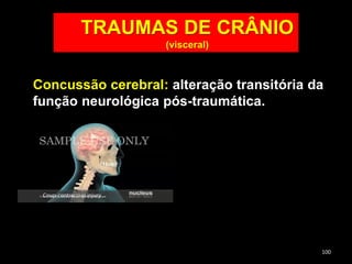 TRAUMAS DE CRÂNIO
(visceral)
Concussão cerebral: alteração transitória da
função neurológica pós-traumática.
100
 