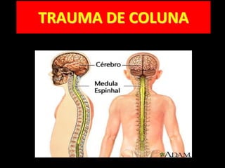 TRAUMA DE COLUNA
 