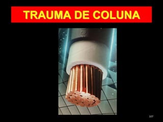 TRAUMA DE COLUNA
107
 