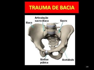 TRAUMA DE BACIA
109
 