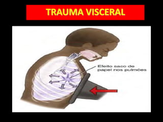 TRAUMA VISCERAL
 