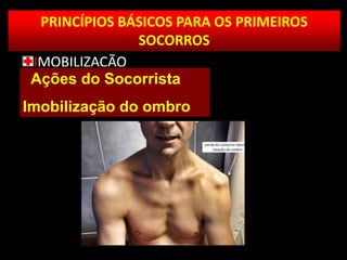 PRINCÍPIOS BÁSICOS PARA OS PRIMEIROS
SOCORROS
IMOBILIZAÇÃO
Ações do Socorrista
Imobilização do ombro
 