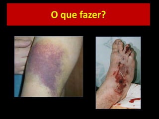 O que fazer?
 