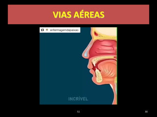 VIAS AÉREAS
51 30
 