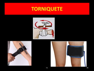 TORNIQUETE
51 85
 
