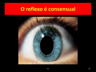 O reflexo é consensual
51 97
 