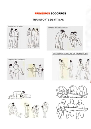 PRIMEIROS SOCORROS
TRANSPORTE DE VÍTIMAS
 