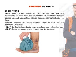 PRIMEIROS SOCORROS
6) CONTUSÃO
Lesão produzida nos tecidos por uma pancada, sem que haja
rompimento da pele, pode ocorrer presença de hematoma (sangue
parado no local). Manifesta-se através da dor de edema (inchação) no
local.
Deve-se proceder da mesma maneira como tratamos de uma
contusão. Cuidados:
- No 1º dia do ato da contusão, deve-se colocar gelo no local ou éter.
- No 2º dia colocar compressas ou bolsa com água quente.
 