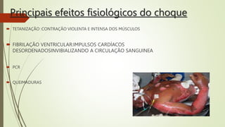 Principais efeitos fisiológicos do choque
 TETANIZAÇÃO :CONTRAÇÃO VIOLENTA E INTENSA DOS MÚSCULOS
 FIBRILAÇÃO VENTRICULAR:IMPULSOS CARDÍACOS
DESORDENADOSINVIBIALIZANDO A CIRCULAÇÃO SANGUINEA
 PCR
 QUEIMADURAS
 