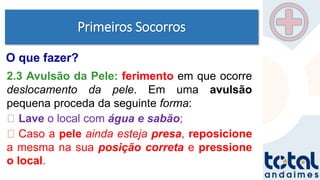Primeiros Socorros
2.3 Avulsão da Pele: ferimento em que ocorre
deslocamento da pele. Em uma avulsão
pequena proceda da seguinte forma:
Lave o local com água e sabão;
Caso a pele ainda esteja presa, reposicione
a mesma na sua posição correta e pressione
o local.
O que fazer?
 