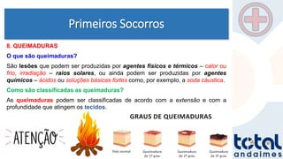 Primeiros Socorros
8. QUEIMADURAS
O que são queimaduras?
São lesões que podem ser produzidas por agentes físicos e térmicos – calor ou
frio, irradiação – raios solares, ou ainda podem ser produzidas por agentes
químicos – ácidos ou soluções básicas fortes como, por exemplo, a soda cáustica.
Como são classificadas as queimaduras?
As queimaduras podem ser classificadas de acordo com a extensão e com a
profundidade que atingem os tecidos.
 