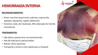HEMORRAGIAINTERNA
RECONHECIMENTO:
• Sinais: manchas (equimose), sudorese, taquicardia,
agitação, taquipneia, rigidez abdominal;
• Sintomas: sede, dor localizada, ANC (alteração de nível de
consciência).
TRATAMENTO:
• Não deixe a pessoa ficar se movimentando;
• Não dê nada para a pessoa beber;
• Manter vítima aquecida;
• Transporte a vítima o mais rápido para o Hospital.
 