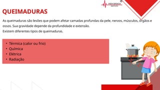 As queimaduras são lesões que podem afetar camadas profundas da pele, nervos, músculos, órgãos e
ossos. Sua gravidade depende da profundidade e extensão.
Existem diferentes tipos de queimaduras.
QUEIMADURAS
• Térmica (calor ou frio)
• Química
• Elétrica
• Radiação
 