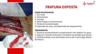 FRATURA EXPOSTA
COMO RECONHECER:
1. Dor local;
2. Hematomas;
3. Inchaço;
4. Deformação no alinhamento;
5. Perda de movimentação;
6. Exposição do osso, acompanhado de sangramento.
TRATAMENTO:
1. Estancar primeiramente o sangramento com atadura ou gaze;
2. Segure o membro fraturado e imobilize na posição que estiver;
3. Imobilize desde uma articulação acima até a outra logo abaixo
da fratura.
 
