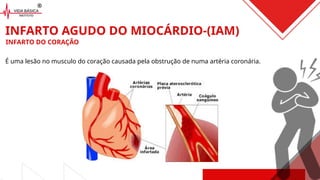 É uma lesão no musculo do coração causada pela obstrução de numa artéria coronária.
INFARTO AGUDO DO MIOCÁRDIO-(IAM)
INFARTO DO CORAÇÃO
 
