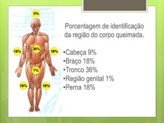 Porcentagem de identificação
da região do corpo queimada.
•Cabeça 9%
•Braço 18%
•Tronco 36%
•Região genital 1%
•Perna 18%
 