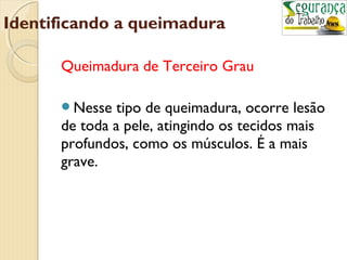 Identificando a queimadura 
Queimadura de Terceiro Grau 
Nesse tipo de queimadura, ocorre lesão 
de toda a pele, atingindo os tecidos mais 
profundos, como os músculos. É a mais 
grave. 
 