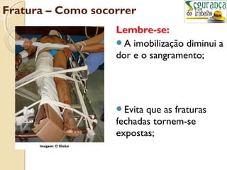Fratura – Como socorrer 
Lembre-se: 
A imobilização diminui a 
dor e o sangramento; 
Evita que as fraturas 
fechadas tornem-se 
expostas; 
 