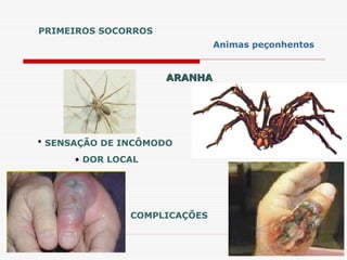 ARANHA
ARANHA
• SENSAÇÃO DE INCÔMODO
• DOR LOCAL
COMPLICAÇÕES
PRIMEIROS SOCORROS
Animas peçonhentos
 
