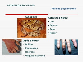 JARARACA
JARARACA Antes de 6 horas
Antes de 6 horas
• Dor
• Edema
• Calor
• Rubor
Após 6 horas
Após 6 horas
• Bolhas
• Equimoses
• Necrose
• Oligúria e Anúria
PRIMEIROS SOCORROS
Animas peçonhentos
 
