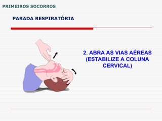 PRIMEIROS SOCORROS
PARADA RESPIRATÓRIA
2. ABRA AS VIAS AÉREAS
(ESTABILIZE A COLUNA
CERVICAL)
 