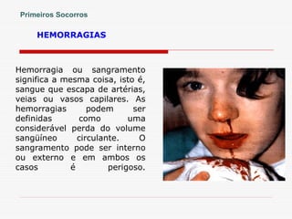 HEMORRAGIAS
Hemorragia ou sangramento
significa a mesma coisa, isto é,
sangue que escapa de artérias,
veias ou vasos capilares. As
hemorragias podem ser
definidas como uma
considerável perda do volume
sangüíneo circulante. O
sangramento pode ser interno
ou externo e em ambos os
casos é perigoso.
Primeiros Socorros
 