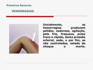 HEMORRAGIAS
Inicialmente, as
hemorragias produzem
palidez, sudorese, agitação,
pele fria, fraqueza, pulso
fraco e rápido, baixa pressão
arterial, sede, e por fim, se
não controladas, estado de
choque e morte.
Primeiros Socorros
 