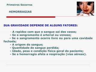 HEMORRAGIAS
SUA GRAVIDADE DEPENDE DE ALGUNS FATORES:
- A rapidez com que o sangue sai dos vasos;
- Se o sangramento é arterial ou venoso;
- Se o sangramento ocorre livre ou para uma cavidade
fechada;
- A origem do sangue;
- Quantidade de sangue perdida;
- Idade, peso e condição física geral do paciente;
- Se a hemorragia afeta a respiração (vias aéreas).
Primeiros Socorros
 