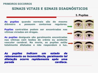 SINAIS VITAIS E SINAIS DIAGNÓSTICOS
3. Pupilas
3. Pupilas
As pupilas quando normais são do mesmo
diâmetro e possuem contornos regulares.
Pupilas contraídas podem ser encontradas nas
vítimas viciadas em drogas.
As pupilas desiguais são geralmente encontradas
nas vítimas com lesões de crânio ou acidente
vascular cerebral. Na morte, as pupilas estão
totalmente dilatadas e não respondem à luz.
As pupilas indicam um estado de
As pupilas indicam um estado de
relaxamento ou inconsciência, geralmente tal
relaxamento ou inconsciência, geralmente tal
dilatação ocorre rapidamente após uma
dilatação ocorre rapidamente após uma
parada cardíaca.
parada cardíaca.
PRIMEIROS SOCORROS
 