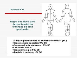 QUEIMADURAS
• Cabeça e pescoço: 9% da superfície corporal (SC)
• Cada membro superior: 9% SC
• Cada quadrante do tronco: 9% SC
• Cada coxa 9% SC
• Cada perna e pé: 9% SC
• Genitais e períneo: 1% SC
Regra dos Nove para
determinação da
extensão da área
queimada:
 