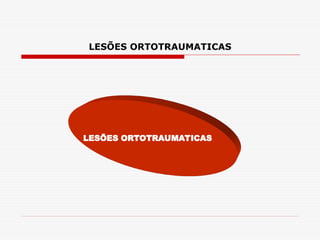 LESÕES ORTOTRAUMATICAS
LESÕES ORTOTRAUMATICAS
 