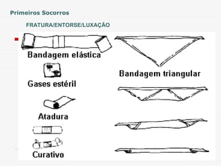 FRATURA/ENTORSE/LUXAÇÃO
Primeiros Socorros
 