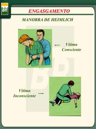 ENGASGAMENTO
MANOBRA DE HEIMLICH
Vítima
Consciente
Vítima
Inconsciente
 