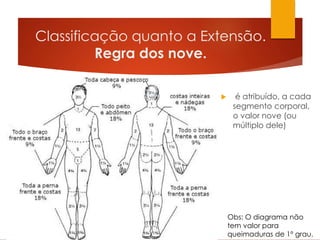 Classificação quanto a Extensão.
Regra dos nove.
Obs: O diagrama não
tem valor para
queimaduras de 1º grau.
 é atribuído, a cada
segmento corporal,
o valor nove (ou
múltiplo dele)
 