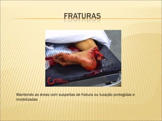 Mantendo as áreas com suspeitas de fratura ou luxação protegidas e imobilizadas 