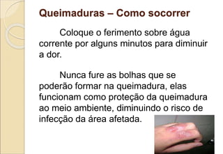 Coloque o ferimento sobre água
corrente por alguns minutos para diminuir
a dor.
Nunca fure as bolhas que se
poderão formar na queimadura, elas
funcionam como proteção da queimadura
ao meio ambiente, diminuindo o risco de
infecção da área afetada.
Queimaduras – Como socorrer
 