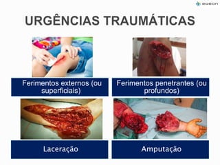 Laceração
Ferimentos externos (ou
superficiais)
Amputação
Ferimentos penetrantes (ou
profundos)
 