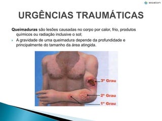 Queimaduras são lesões causadas no corpo por calor, frio, produtos
químicos ou radiação inclusive o sol;
 A gravidade de uma queimadura depende da profundidade e
principalmente do tamanho da área atingida.
 