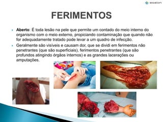  Aberto: É toda lesão na pele que permite um contado do meio interno do
organismo com o meio externo, propiciando contaminação que quando não
for adequadamente tratado pode levar a um quadro de infecção.
 Geralmente são visíveis e causam dor, que se dividi em ferimentos não
penetrantes (que são superficiais), ferimentos penetrantes (que são
profundos atingindo órgãos internos) e as grandes lacerações ou
amputações.
 