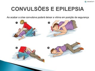 Ao acabar a crise convulsiva poderá deixar a vitima em posição de segurança
 