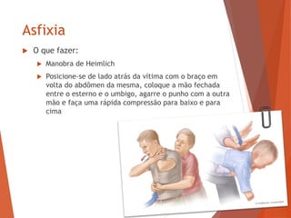 Asfixia
 O que fazer:
 Manobra de Heimlich
 Posicione-se de lado atrás da vítima com o braço em
volta do abdômen da mesma, coloque a mão fechada
entre o esterno e o umbigo, agarre o punho com a outra
mão e faça uma rápida compressão para baixo e para
cima
 