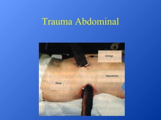 Trauma Abdominal

 